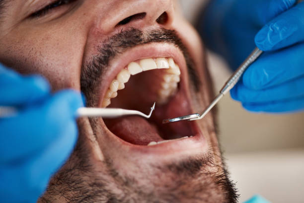Best Knocked-Out Tooth Emergency  in North Fair Oaks, CA