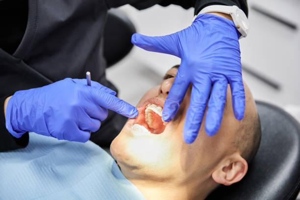 Best Knocked-Out Tooth Emergency  in North Fair Oaks, CA